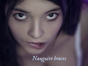 Nauguire_braces